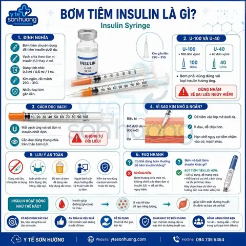 1/10 Net 30 Là Gì? Hướng Dẫn Chi Tiết Về Điều Khoản Chiết Khấu Thanh Toán Cho Doanh Nghiệp