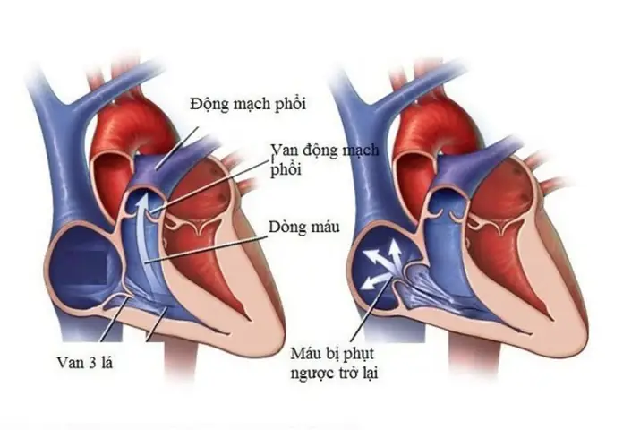 Vạn Là Bao Nhiêu? Hướng Dẫn Quy Đổi & Ý Nghĩa Đầy Đủ Nhất