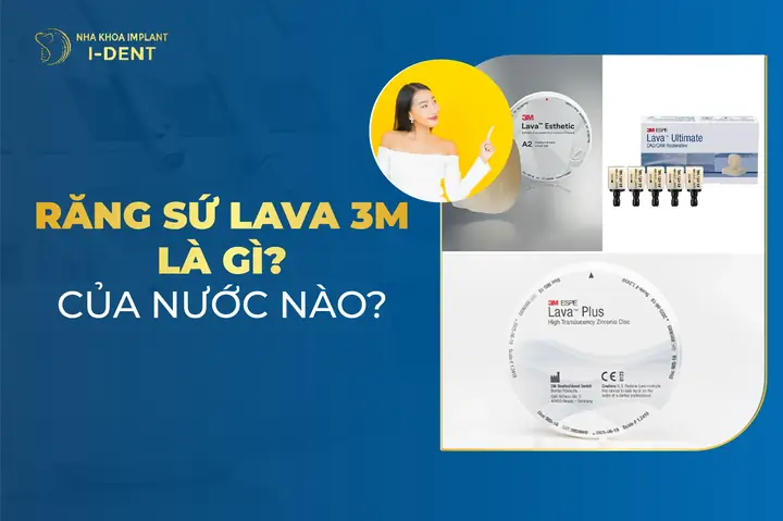 Răng Sứ 3m Espe Lava Là Gì? Các Loại, Ưu Điểm Và Ứng Dụng Chi Tiết