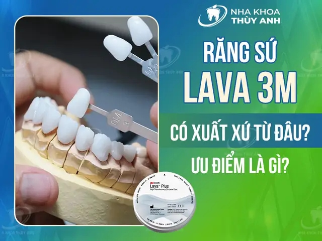 3m Trong Sản Xuất Là Gì? Khám Phá Mô Hình Pro-3m & Ý Nghĩa