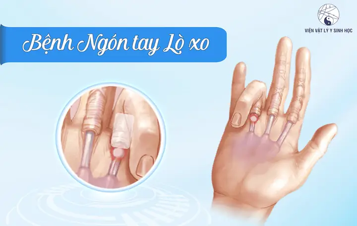 A Lô Xô Là Gì? Nguồn Gốc, Ý Nghĩa Và Cách Dùng Trong Thực Tế