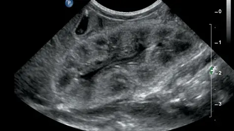 Acidosis Là Gì? Nguyên Nhân, Triệu Chứng Và Cách Điều Trị Tình Trạng Nhiễm Toan