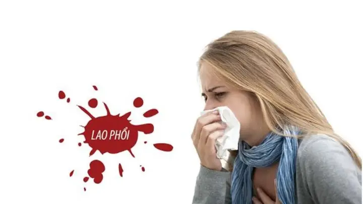 Xét Nghiệm Đờm Afb Là Gì? Ý Nghĩa, Quy Trình Và Kết Quả Chẩn Đoán Lao