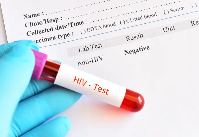 Aids Là Gì? Nguyên Nhân, Triệu Chứng Và Cách Phòng Ngừa Hiệu Quả