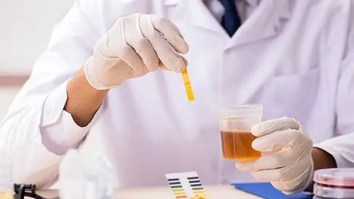 Tỷ Lệ Albumin/creatinin (acr): Chỉ Số Vàng Đánh Giá Chức Năng Thận