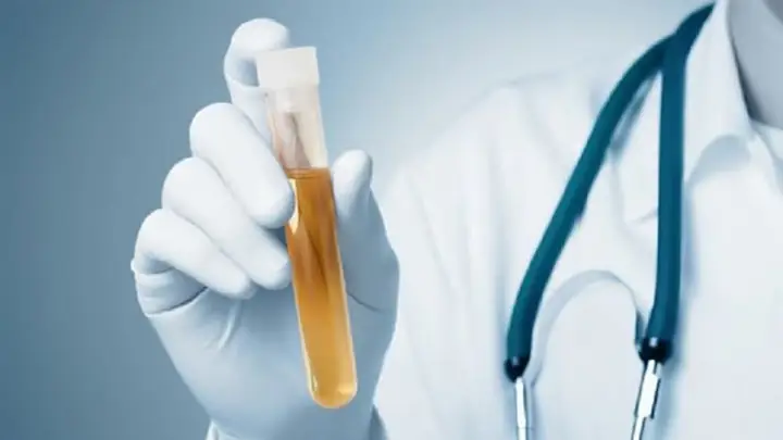 Tỷ Lệ Albumin/creatinin (acr): Chỉ Số Vàng Đánh Giá Chức Năng Thận
