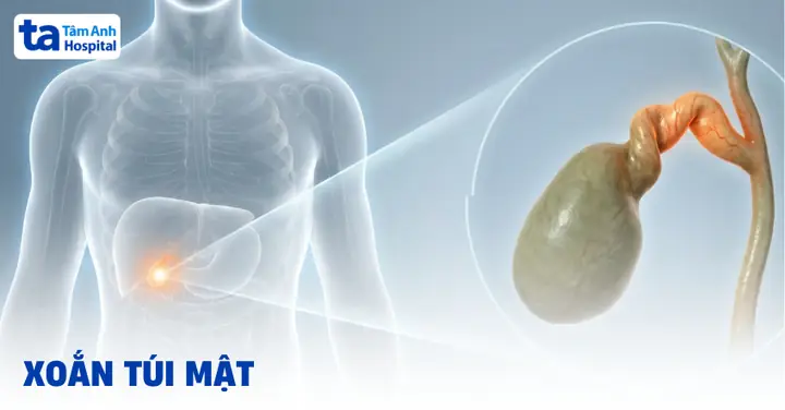 Angiodysplasia Là Gì? Nguyên Nhân, Triệu Chứng Và Dấu Hiệu Nhận Biết