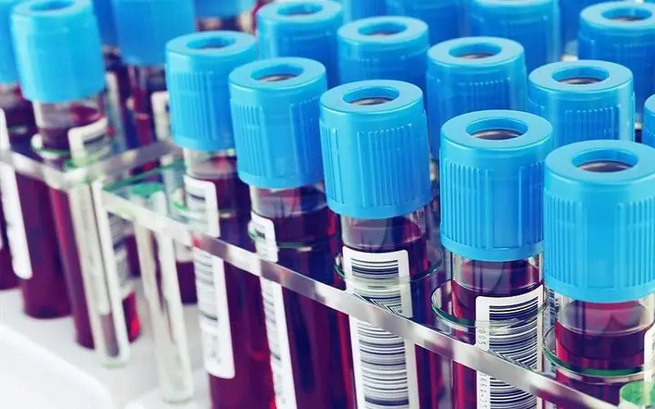 Anti Gad Là Gì? Ý Nghĩa Của Xét Nghiệm Kháng Thể Anti-gad Trong Chẩn Đoán