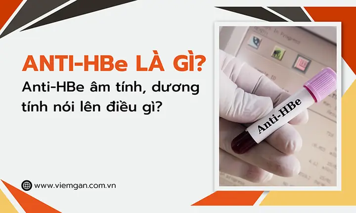 Anti Hbe Dương Tính Nghĩa Là Gì? Ý Nghĩa Chỉ Số & Dấu Hiệu Chuyển Đổi Huyết Thanh