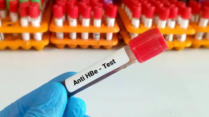 Anti Hbe Dương Tính Nghĩa Là Gì? Ý Nghĩa Chỉ Số & Dấu Hiệu Chuyển Đổi Huyết Thanh