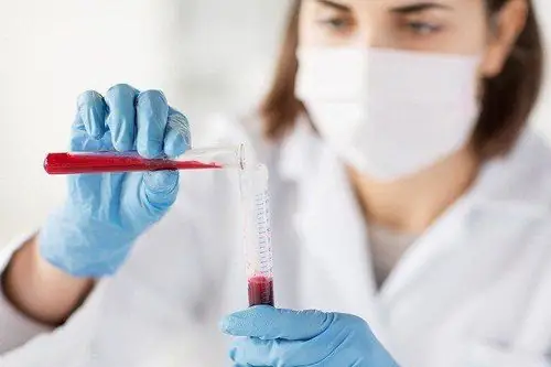 Anti Hbe Dương Tính Nghĩa Là Gì? Ý Nghĩa Chỉ Số & Dấu Hiệu Chuyển Đổi Huyết Thanh