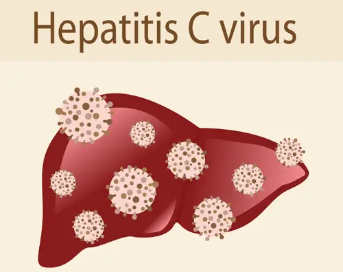 Anti Hcv Negative Là Gì? Ý Nghĩa, Khi Nào Cần Xét Nghiệm Và Cách Đọc Kết Quả Anti Hcv Negative Là Gì? Ý Nghĩa, Khi Nào Cần Xét Nghiệm Và Cách Đọc Kết Quả