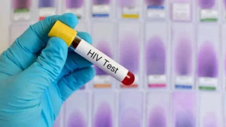 Xét Nghiệm Anti Hiv Nhanh Là Gì? Độ Chính Xác Và Các Yếu Tố Liên Quan