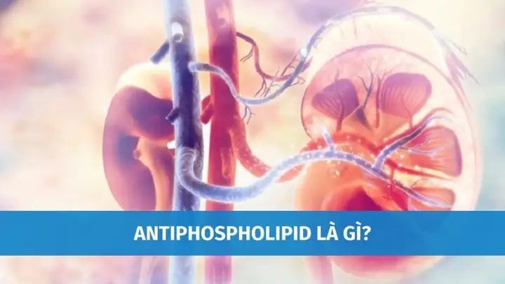 Xét Nghiệm Anti Phospholipid Igg: Ý Nghĩa, Chỉ Định Và Các Yếu Tố Cần Biết