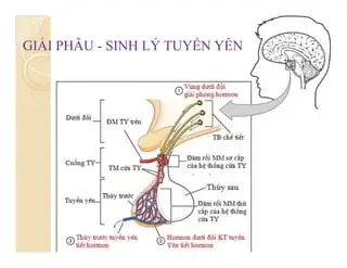 Apoplexy Là Gì? Phân Biệt Các Loại Đột Quỵ Tuyến Yên Và Triệu Chứng