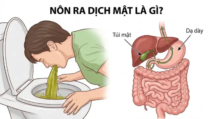 Axit Mật Là Gì? Chức Năng, Vai Trò Và Rối Loạn Liên Quan