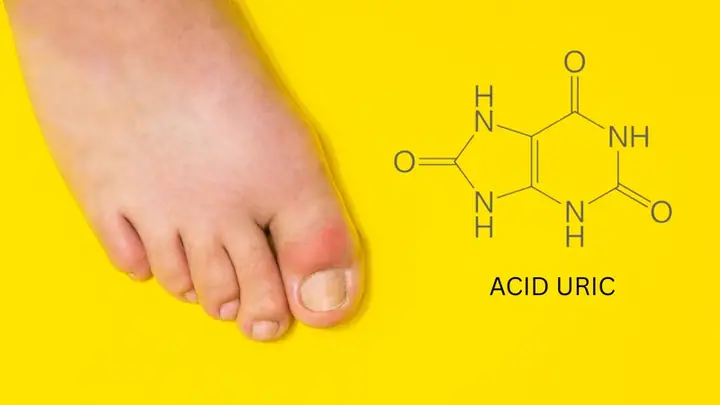 Axit Uric Trong Máu Là Gì? Nồng Độ Bao Nhiêu Là Bình Thường Và Dấu Hiệu Nhận Biết? Axit Uric Trong Máu Là Gì? Nồng Độ Bao Nhiêu Là Bình Thường Và Dấu Hiệu Nhận Biết?