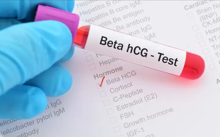 Xét Nghiệm Beta HCG Là Gì? Ý Nghĩa, Cách Đọc Chỉ Số Và Khi Nào Cần Thực Hiện?