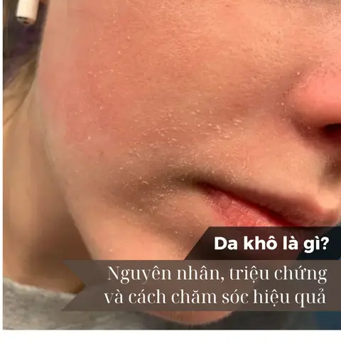 Bà Đa Là Gì? Ý Nghĩa, Nguồn Gốc Và Các Khái Niệm Liên Quan