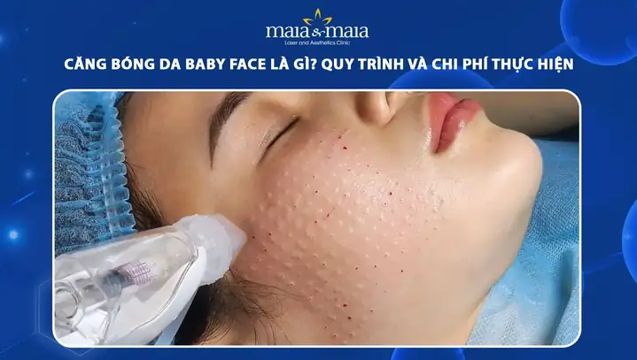 Baby Face Là Gì? Giải Mã Xu Hướng Sở Hữu Gương Mặt Trẻ Thơ Đáng Yêu