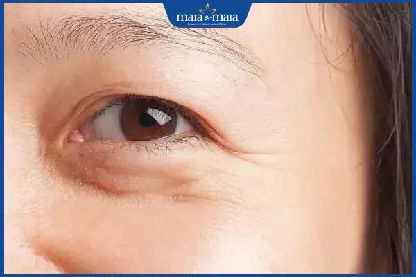 Baby Face Là Gì? Giải Mã Xu Hướng Sở Hữu Gương Mặt Trẻ Thơ Đáng Yêu
