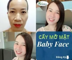 Baby Face Là Gì? Giải Mã Xu Hướng Sở Hữu Gương Mặt Trẻ Thơ Đáng Yêu