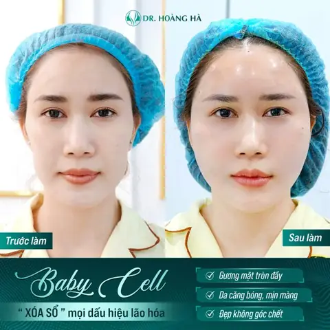Baby Face Là Gì? Giải Mã Xu Hướng Sở Hữu Gương Mặt Trẻ Thơ Đáng Yêu