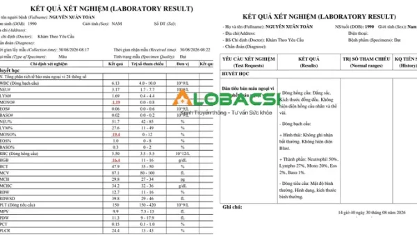 Tăng Bạch Cầu Mono: Nguyên Nhân, Ý Nghĩa Và Dấu Hiệu Cảnh Báo Bệnh Lý