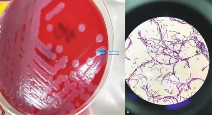 Bacillus Licheniformis Là Gì? Ứng Dụng Và Lợi Ích Toàn Diện