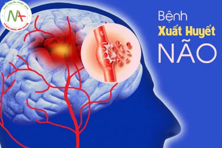 Basal Cisterns: Khám Phá Cấu Trúc Quan Trọng Trong Não Bộ