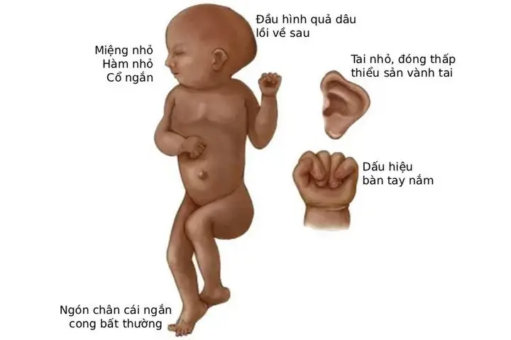 “bé Dâu” Là Gì? Khám Phá Ý Nghĩa Và Những Cách Hiểu Phổ Biến
