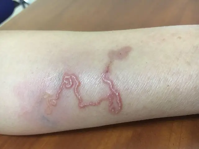 Bệnh Giun Đũa Chó Là Gì? Nguyên Nhân, Dấu Hiệu Và Cách Phòng Ngừa Hiệu Quả