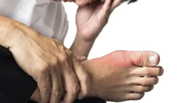 Bệnh Gút Cấp Là Gì? Nguyên Nhân, Triệu Chứng & Cách Xử Trí Hiệu Quả