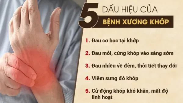 Bệnh Khớp Là Gì? Nguyên Nhân, Triệu Chứng Và Cách Điều Trị Hiệu Quả
