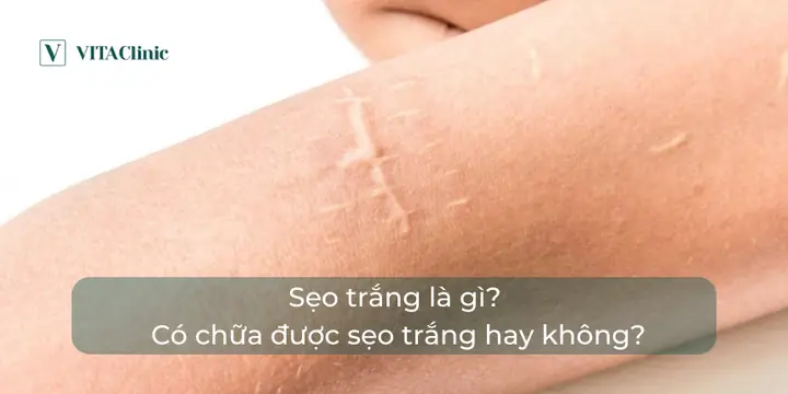 Bệnh Lậu Lâu Năm Là Gì? Nguyên Nhân, Triệu Chứng Và Cách Điều Trị