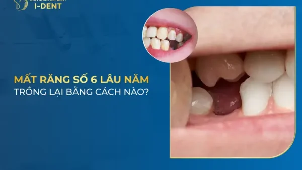 Bệnh Lậu Lâu Năm Là Gì? Nguyên Nhân, Triệu Chứng Và Cách Điều Trị