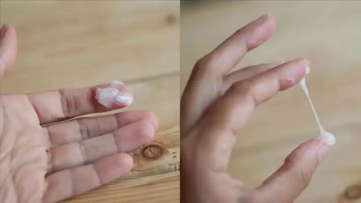Bệnh Lậu Ở Phụ Nữ: Nguyên Nhân, Triệu Chứng, Nguy Hiểm Và Cách Phòng Ngừa Hiệu Quả
