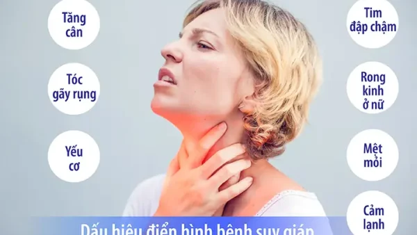 Bệnh Lý Tuyến Giáp Là Gì? Nguyên Nhân, Dấu Hiệu Và Cách Phòng Ngừa