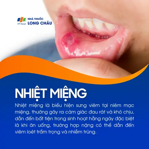 Nhiệt Miệng Là Gì? Nguyên Nhân, Dấu Hiệu Nhận Biết Và Cách Điều Trị Hiệu Quả