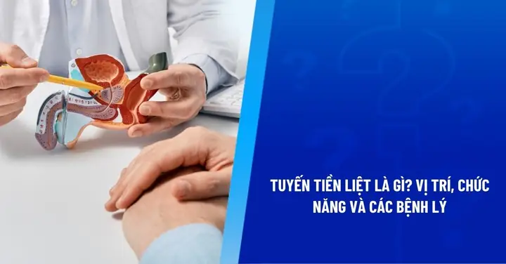 Sỏi Tuyến Tiền Liệt: Nguyên Nhân, Dấu Hiệu Và Cách Chẩn Đoán, Điều Trị