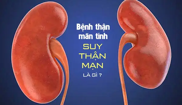 Suy Thận Mạn Là Gì? Nguyên Nhân, Triệu Chứng Và Cách Điều Trị Toàn Diện