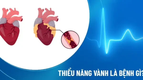 Thiểu Năng Là Gì? Phân Loại, Triệu Chứng Và Cách Nhận Biết