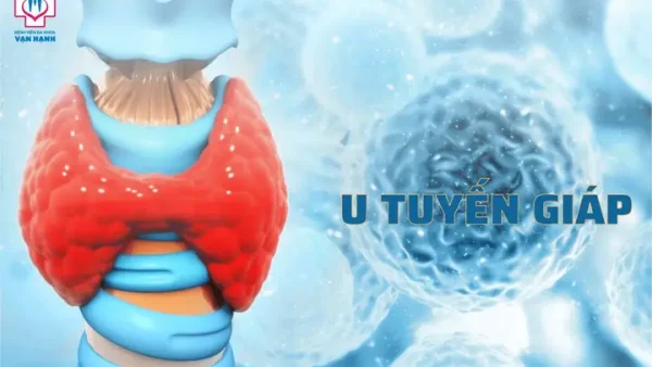 Bệnh Tuyết Giáp Là Gì? Nguyên Nhân, Dấu Hiệu Và Cách Phòng Ngừa Hiệu Quả