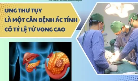 U Tụy Là Gì? Phân Loại, Triệu Chứng, Nguyên Nhân Và Cách Điều Trị