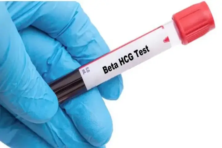 Beta HCG Là Gì? Ý Nghĩa, Cách Đọc Kết Quả Và Khi Nào Cần Xét Nghiệm