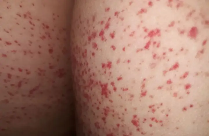 Bi Mẫn Là Gì? Khám Phá Ý Nghĩa Và Vai Trò Trong Đời Sống Tâm Linh
