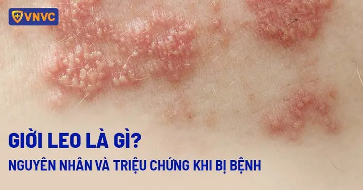 "bị Ốm" Trong Tiếng Hàn Là Gì? Các Cách Diễn Đạt Và Từ Vựng Liên Quan