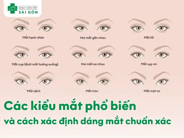 Biến Dị Xác Định Là Gì? Đặc Điểm Và Vai Trò Theo Quan Niệm Của Đacuyn