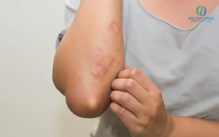 Biểu Hiện Của Bệnh Suy Thận: Dấu Hiệu Nhận Biết Sớm Và Các Vấn Đề Liên Quan