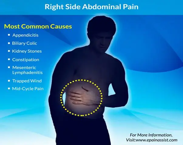 Biliary Colic Là Gì? Nguyên Nhân, Triệu Chứng Và Cách Nhận Biết Đau Quặn Mật